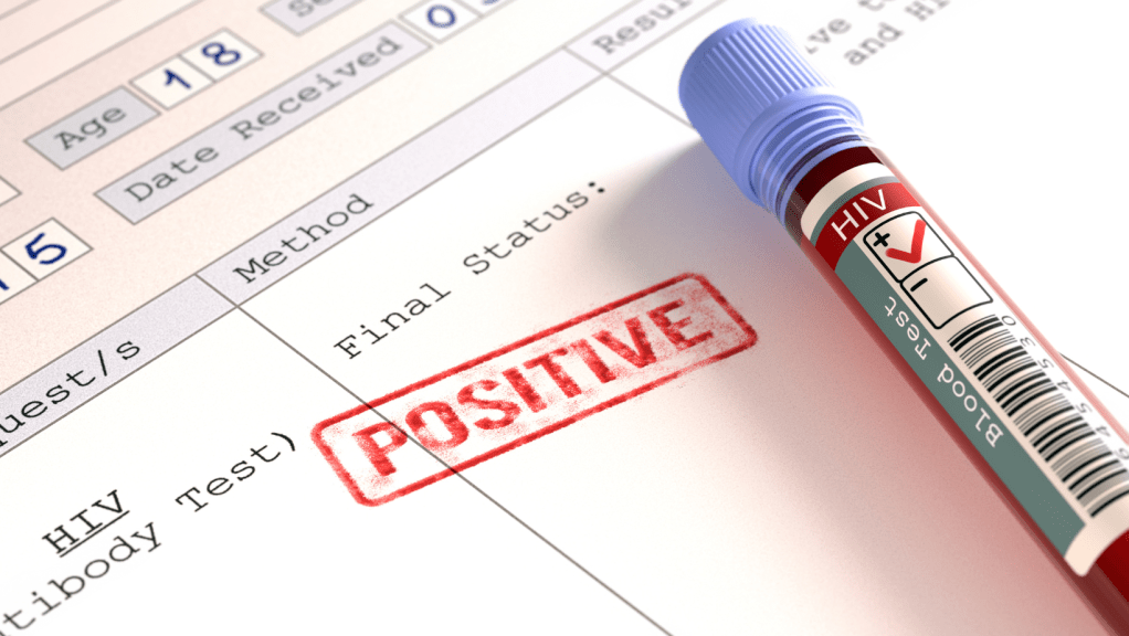 Prevención del VIH en Panamá es una carrera contra el tiempo, cada día aumentan los&nbsp;casos