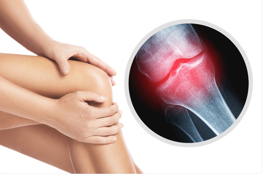 Descubrimiento de hormona en ratones lactantes abre nuevas posibilidades para el tratamiento de la&nbsp;osteoporosis